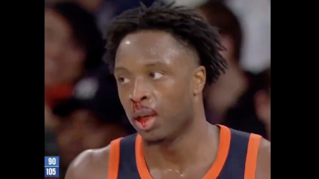og-anunoby-bloody